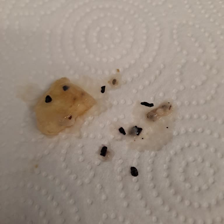 Eti Gıda Lifalif Yulafın İçinden Çıkan Yabancı Cisimler!