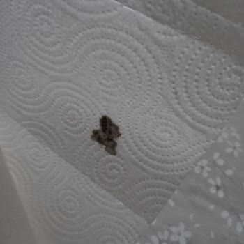 Papia Kağıt Havlu İçinde Belirsiz Siyah Yabancı Maddeler: Hijyen Sorunu