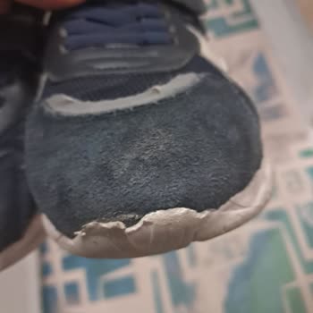 Çocuk Ayakkabısında Erime Problemi Ve Trendyol'un Sorumluluk Reddi