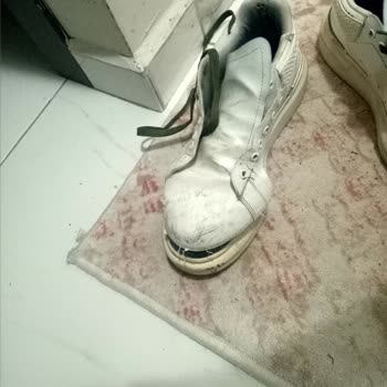 Kepez Devlet Hastanesi Kaza Sonrası Hastanedeki İhmal Ve Yetersiz İlgi!