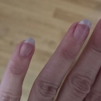 Saten Pijamadaki Aşırı Boya Akması Cilde Ve Eşyalarına Zarar Verdi