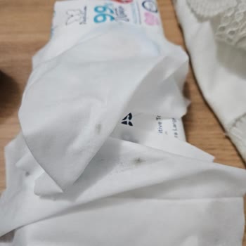 Papilion Islak Havlularında Hijyenik Olmayan Ve Lekeli Ürünler Şikayeti