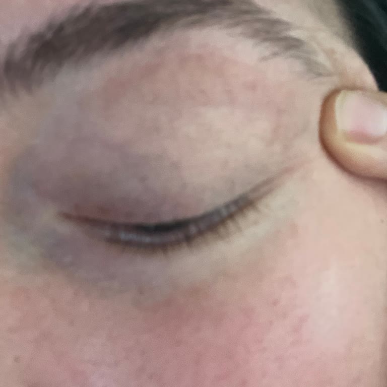 Kalıcı Olmayan İpek Kirpik İşlemi Nedeniyle Ücret İadesi İsteği