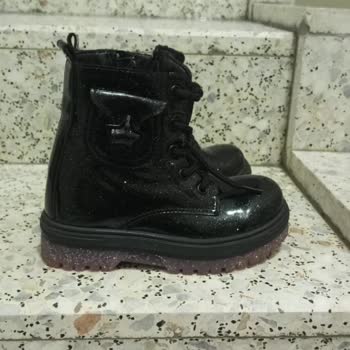 FLO Ayakkabısının Çocuğumun Ayağında Egzama Oluşturması, Maddi Ve Manevi Zarar