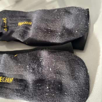 Wedze Kayak Çorabı Kalite Sorunu: Hızlı Tiftiklenme Ve Destek Yok