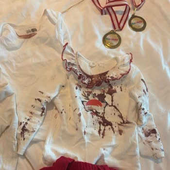 Regnum Carya Hotels Kids Club’da Güvenlik İhmali Çocuğum Derin Kesik Aldı