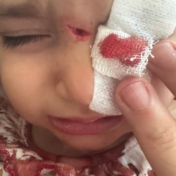 Regnum Carya Hotels Kids Club’da Güvenlik İhmali Çocuğum Derin Kesik Aldı