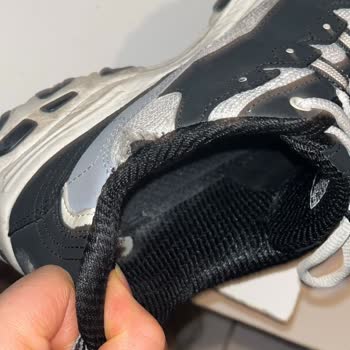 Skechers Ayakkabılarda Kalite Sorunu Ve Garanti İhlali