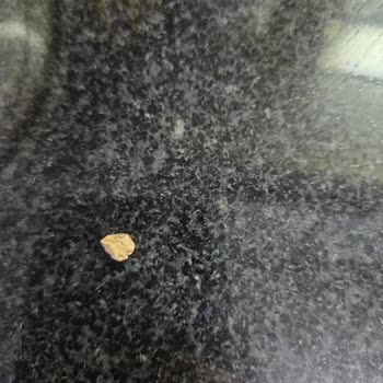 Hasata Yeşil Mercimekte Taş: Sağlık Riski