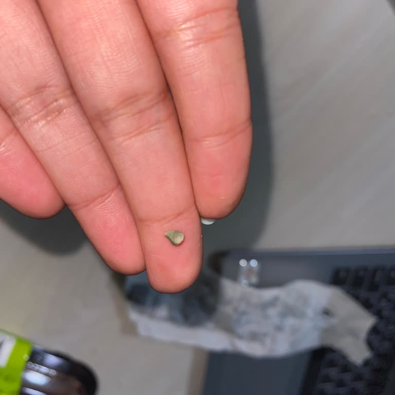 A101 Soğuk Baklava İçinde Taş Bulunması Ve Sağlık Güvensizliği