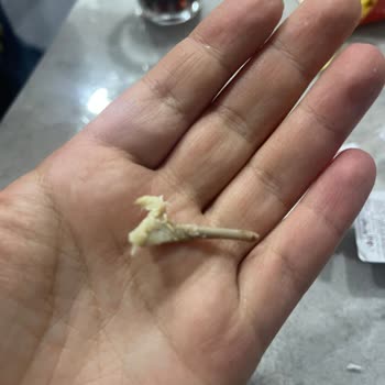 Soğuk Gelen Tavuk Burgerde Kemik Çocuk Dişine Çarptı Ücret İadesi Talebi