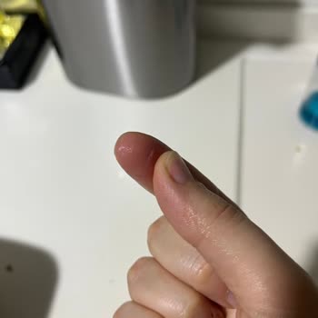 Dost Yoğurdun Ambalajındaki Keskin Kenarlar Parmağımı Kesti