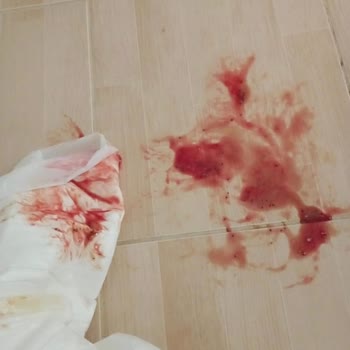 Baba Kız Veteriner Kliniği İhmal Ve Hatalı Tedavi Kedimizi Ölümle Sonlandırdı