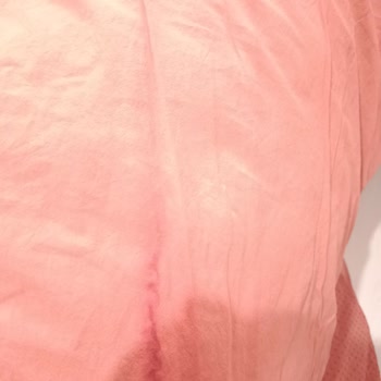 Bed-Line Nevresim Setinde İlk Yıkamada Renk Atması Ve Değişim Talebi