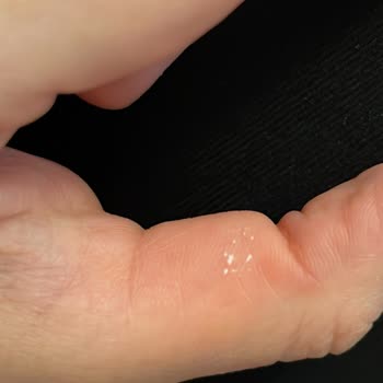 Vanish Oxi Action Ürünün Cilt Teması Uyarısının Eksikliği Ve Yanma Şikayeti