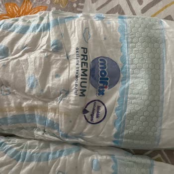 Hepsiburada’dan Çakma Molfix Bezlerde Şiddetli Pişik