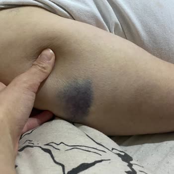 Atlas Hastanesi Kalp Krizi Şüphesiyle Giriş Yapan Hastanın Yoğun Bakım Hataları