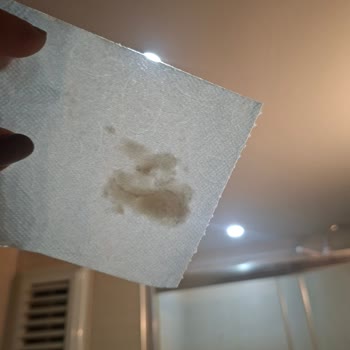 Solo Organik Bambu Katkılı Tuvalet Kağıdında Görüntü Sorunu Ve Hijyen Endişesi