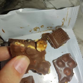 Kahve Dünyası Çikolatasında Çürük Ve Sert Fındıklar Nedeniyle Diş Kırılması