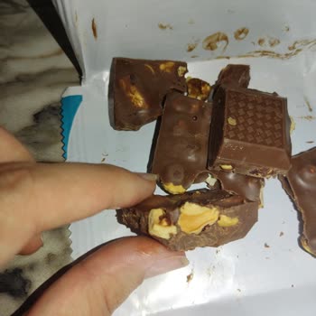 Kahve Dünyası Çikolatasında Çürük Ve Sert Fındıklar Nedeniyle Diş Kırılması