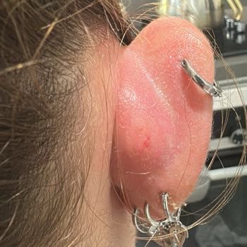 Bipiercing’de 14 Yaşındaki Kardeşimin İzinsiz Kulak Piercingi Ve Şiddetli Sağlık Sorunları