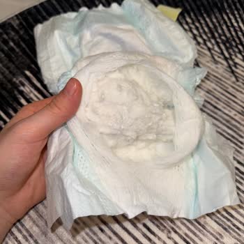 Prima Premium Care Bebek Bezinde Sert Parçalar Ve Hijyen Endişesi