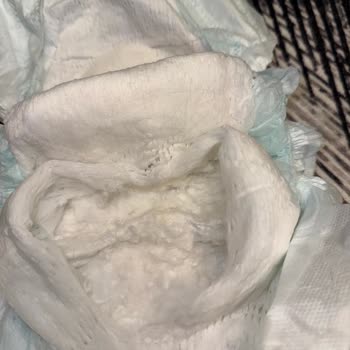 Prima Premium Care Bebek Bezinde Sert Parçalar Ve Hijyen Endişesi