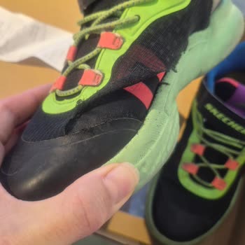 Skechers Çocuk Ayakkabısında Tekrarlayan Yırtılma Sorunu Ve Ücret İadesi Talebi