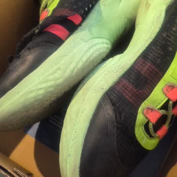 Skechers Çocuk Ayakkabısında Tekrarlayan Yırtılma Sorunu Ve Ücret İadesi Talebi