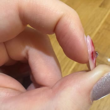 Hijyen Ve Bakteriyel Risk Nedeniyle Çilek Nail House'tan Açıklama Ve Özür Talebi