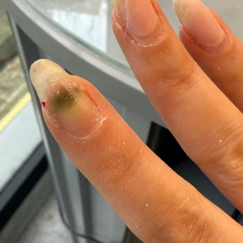 Hijyen Ve Bakteriyel Risk Nedeniyle Çilek Nail House'tan Açıklama Ve Özür Talebi