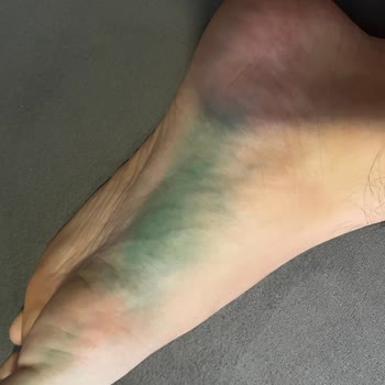 Intersport Alınan Adidas Ayakkabısında Boya Sızıntısı Çocuğumun Ayaklarını Boyadı