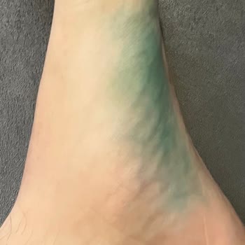 Intersport Alınan Adidas Ayakkabısında Boya Sızıntısı Çocuğumun Ayaklarını Boyadı