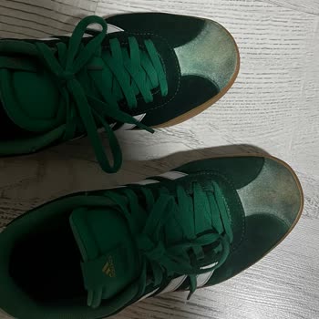 Intersport Alınan Adidas Ayakkabısında Boya Sızıntısı Çocuğumun Ayaklarını Boyadı