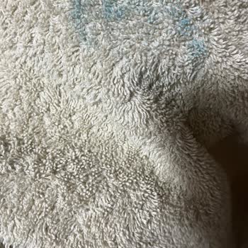 Intersport Alınan Adidas Ayakkabısında Boya Sızıntısı Çocuğumun Ayaklarını Boyadı