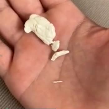 Falım Benim Hayatımı Nasıl Riske Attı?