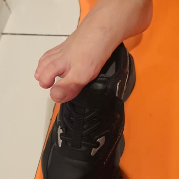 Çocuk Ayakkabısının Ayağını Yaralaması Ve Kısa Sürede Açılması İade Talebi