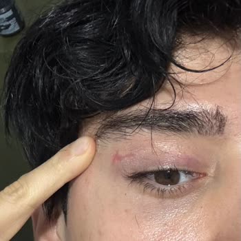 Veni Vidi Caddebostan Göz Hastanesi Şikayeti