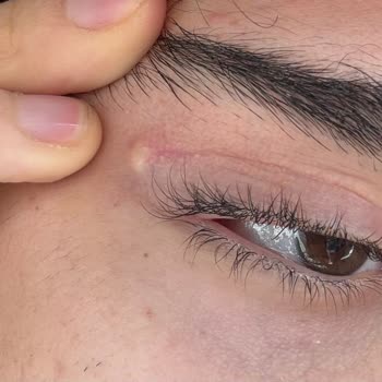 Veni Vidi Caddebostan Göz Hastanesi Şikayeti