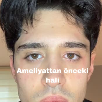 Veni Vidi Caddebostan Göz Hastanesi Şikayeti