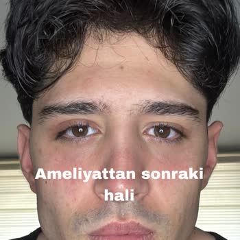 Veni Vidi Caddebostan Göz Hastanesi Şikayeti