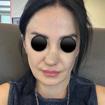 Eki aç