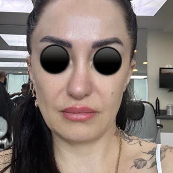 Eki aç