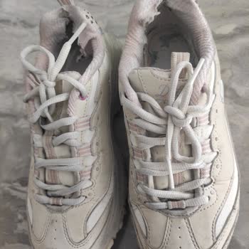 Skechers Ayakkabısının Kısa Sürede Deforme Olması Ve İade Reddi