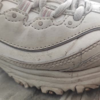 Skechers Ayakkabısının Kısa Sürede Deforme Olması Ve İade Reddi