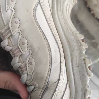 Skechers Ayakkabısının Kısa Sürede Deforme Olması Ve İade Reddi