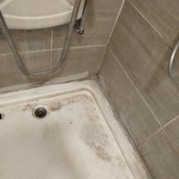 Hijyen Eksikliği Hastalarda Enfeksiyon Riski Oluşturuyor