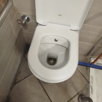 Hijyen Eksikliği Hastalarda Enfeksiyon Riski Oluşturuyor