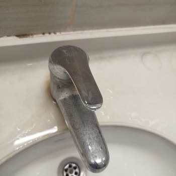 Hijyen Eksikliği Hastalarda Enfeksiyon Riski Oluşturuyor