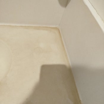 Hijyen Eksikliği Hastalarda Enfeksiyon Riski Oluşturuyor